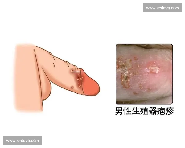 男性健康问题全面解析 探索男科常见疾病预防与治疗方法